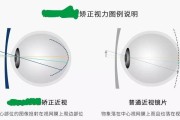 星焦点离焦镜手机拍照效果如何？