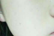 手机照片出现斑点如何修复？