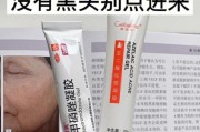 华硕笔记本怎么样去黑头？去黑头的方法有哪些？