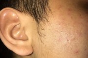 手机拍照出现白点的可能原因是什么？如何解决？