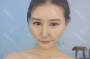 链子手机拍照效果不佳如何优化？有哪些技巧？
