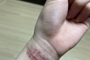 手机手腕拍照技巧有哪些？如何提高照片清晰度？
