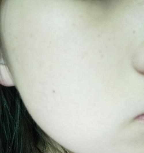 手机照片出现斑点如何修复？