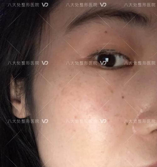 手机照片出现斑点如何修复？