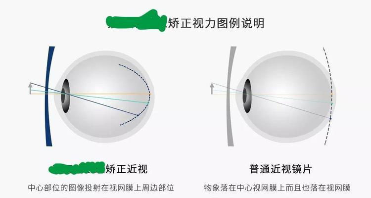 星焦点离焦镜手机拍照效果如何？