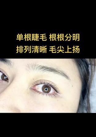 苹果手机灵动感是什么意思？如何体验？